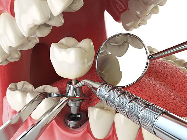 Professional Emergency Dental Service in NY